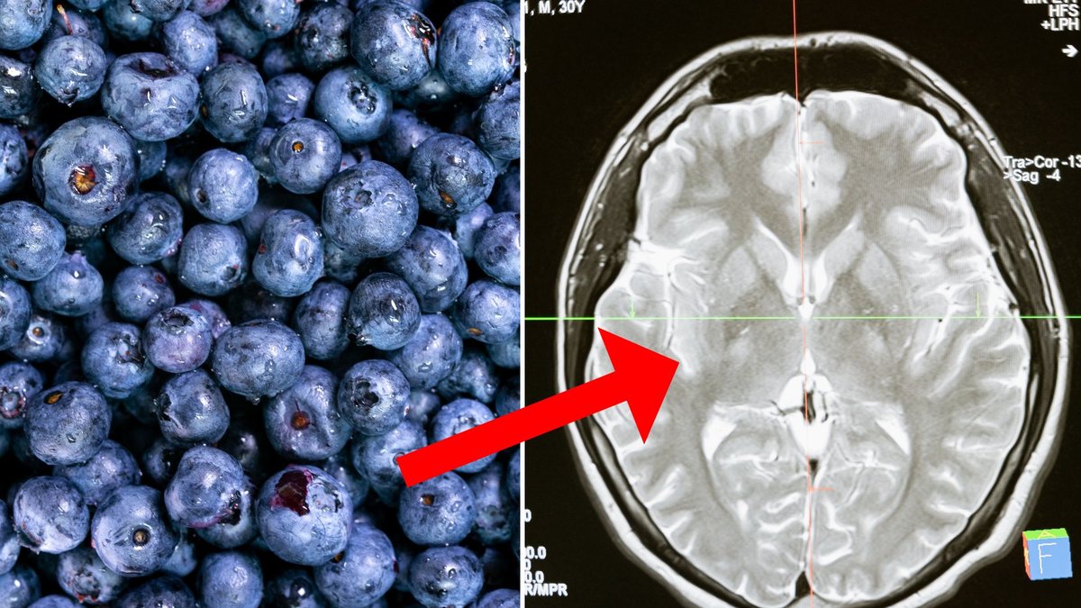 Blåbär är en av många matvaror som är bra för hjärnan.